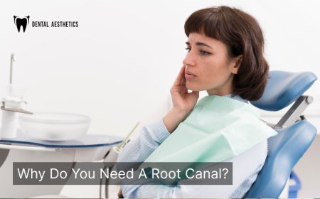 Understanding the Root Canal Procedure Price in Lahore – Dental Aesthetics