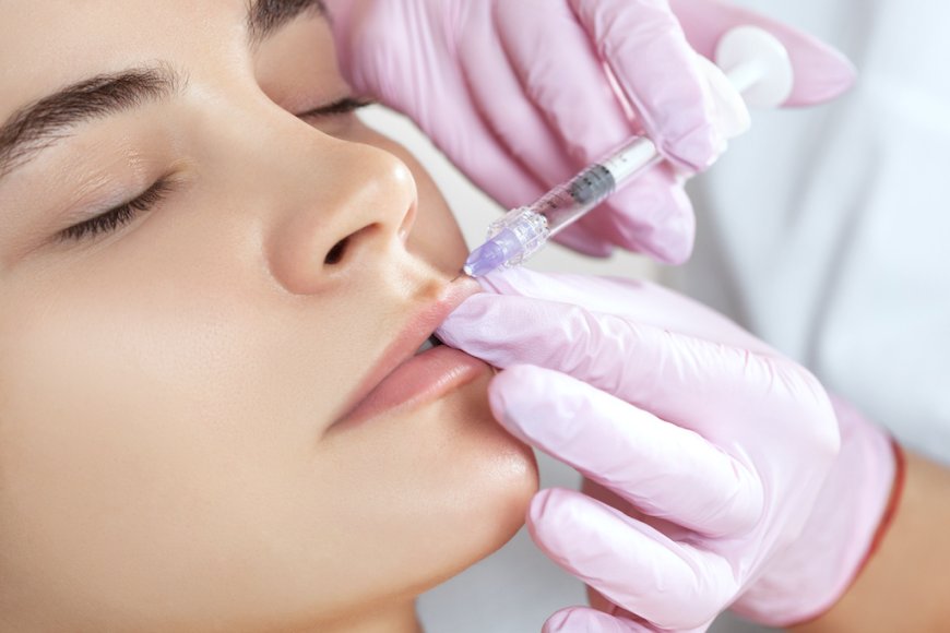 How Long Do Dermal Fillers Last?