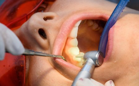 Root Canal vs. Tooth Extraction: Which Is Better?