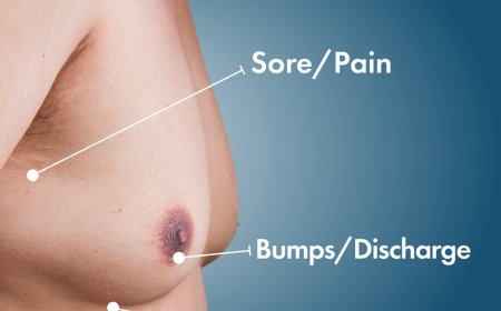 Top Clinics for Gynecomastia in Islamabad: Where to Go in 2025