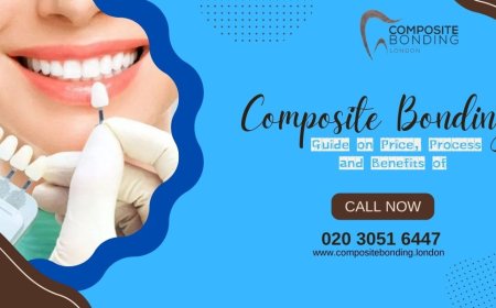 Guide on Price, Process and Benefits of Composite Bonding