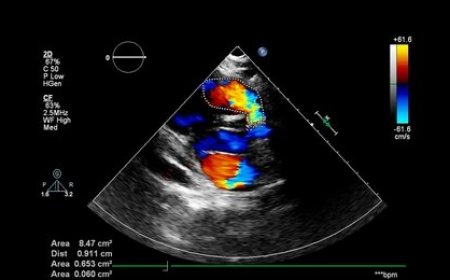 Understanding Colour Doppler Test Price: A Comprehensive Guide Before Booking